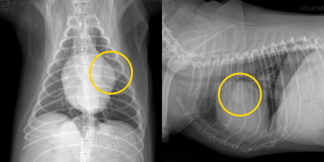 폐 종괴가 확인된 복배상·측면 흉부 X-ray