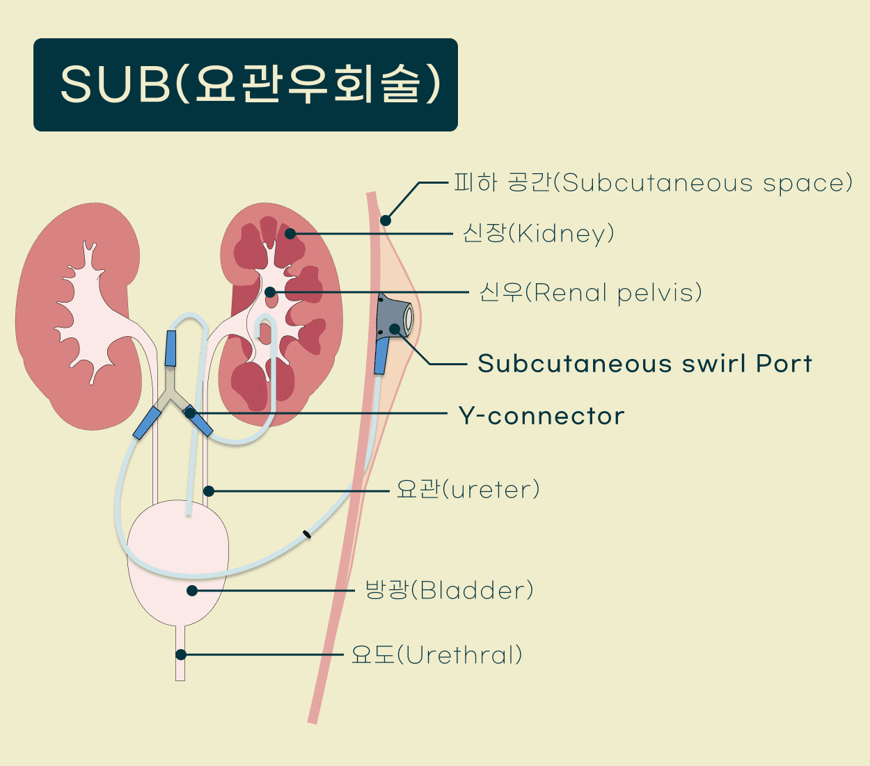고양이 SUB(인공요관우회술) 수술 케이스 관련 이미지 5