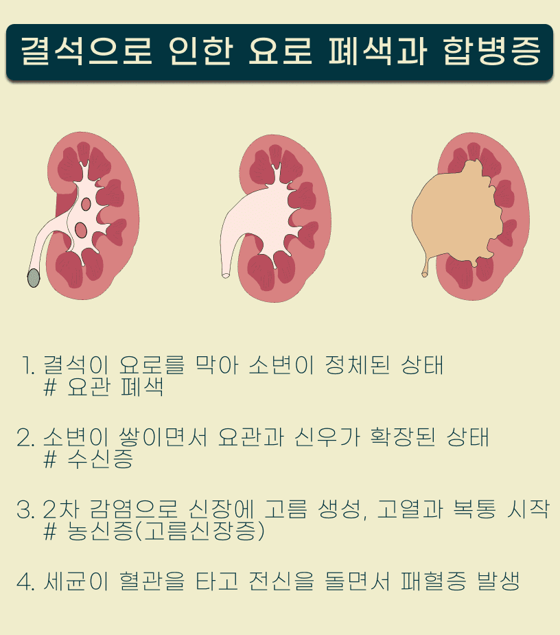 고양이 SUB(인공요관우회술) 수술 케이스 관련 이미지 3