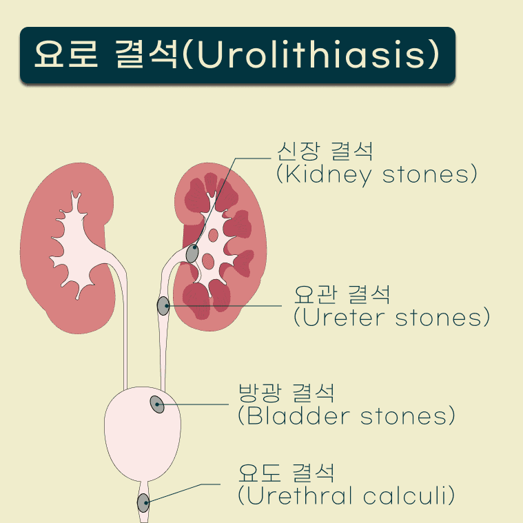 고양이 SUB(인공요관우회술) 수술 케이스 관련 이미지 2