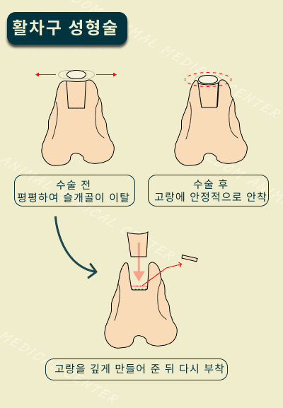 강아지 슬개골 탈구 DFO 교정 수술 관련 이미지 6